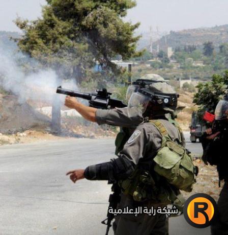 3 إصابات برصاص الاحتلال في الرام شمال القدس