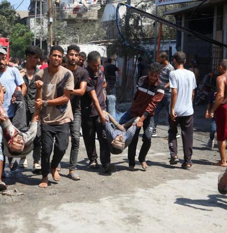 إصابة مواطنة بنيران الاحتلال جنوب قطاع غزة