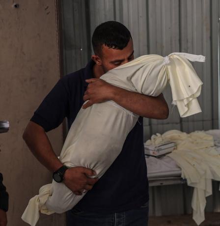 غزة: 326 وفاة بسبب سوء التغذية ونقص الدواء وأكثر من 300 حالة إجهاض