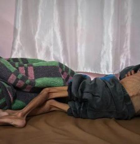 "أونروا": حالات سوء التغذية بين الأطفال في غزة زادت بمقدار 3 مرات