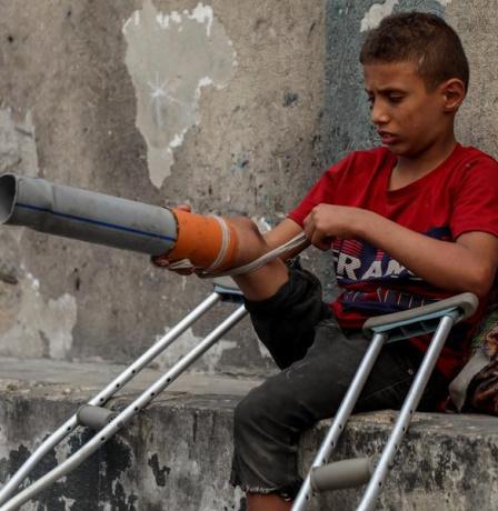 "جمعية بيت لحم للتأهيل" تبدأ حصر بيانات الأطفال مبتوري الأطراف لتوفير أطراف صناعية متطورة