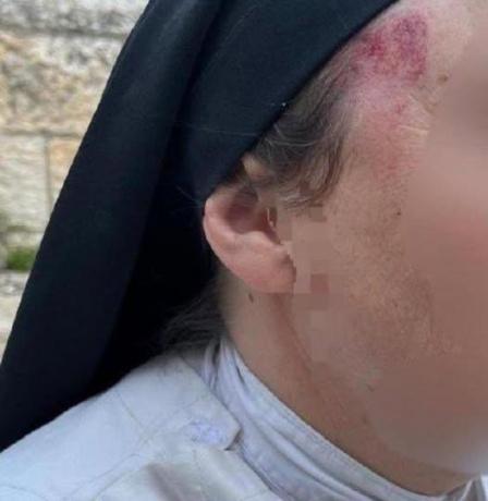 حين تُضرب الراهبة… تُفضَح المدينة