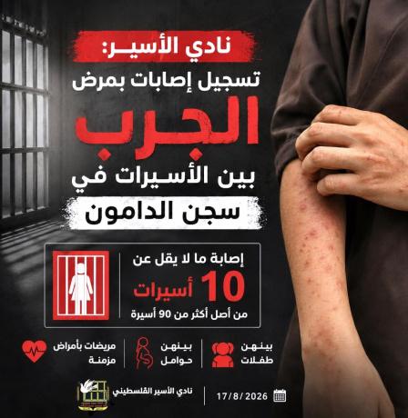 نادي الأسير: تسجيل إصابات بمرض الجرب (السكابيوس) بين صفوف الأسيرات في سجن الدامون