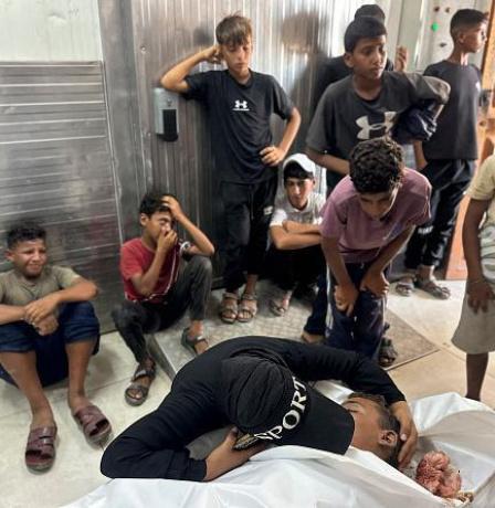 غزة: شهيد متأثرا بإصابته والحصيلة ترتفع إلى 73,400