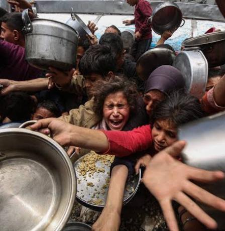 غزة: معدلات سوء التغذية والتجويع بلغت مستويات كارثية