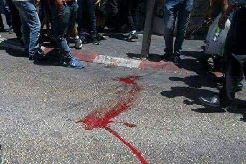 وفاة طفلة دهسا وسط مدينة رام الله