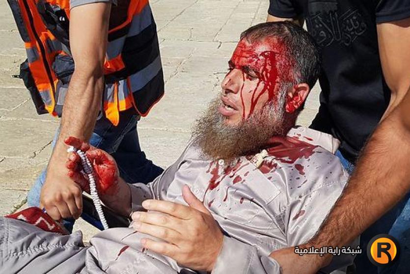 إصابة أحد المصلين في المسجد الأقصى