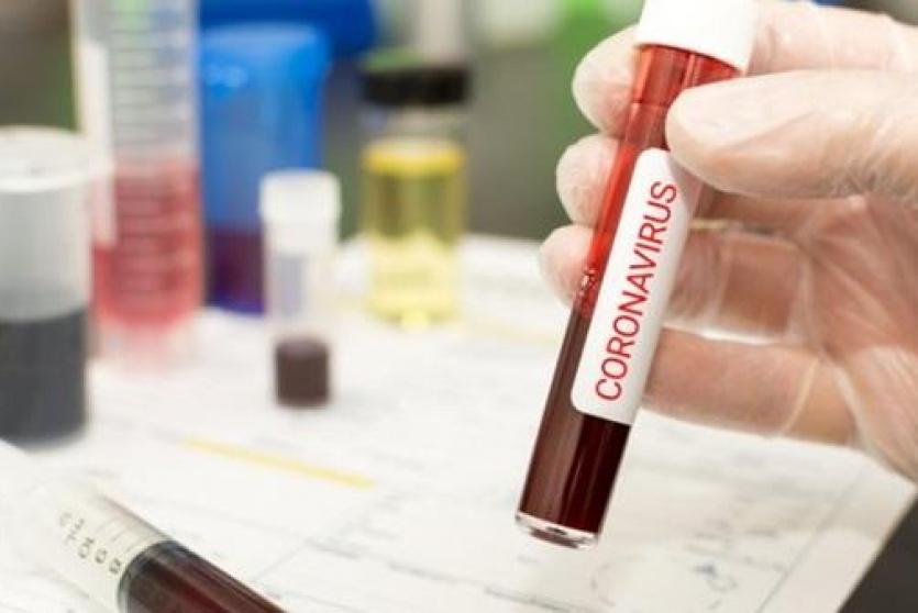 تحذير من اختبارات الأجسام المضادة  لفيروس كورونا