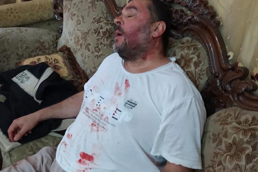 الاحتلال يعتدي بالضرب على  الأسير المحرر المقعد عدنان حمارشة
