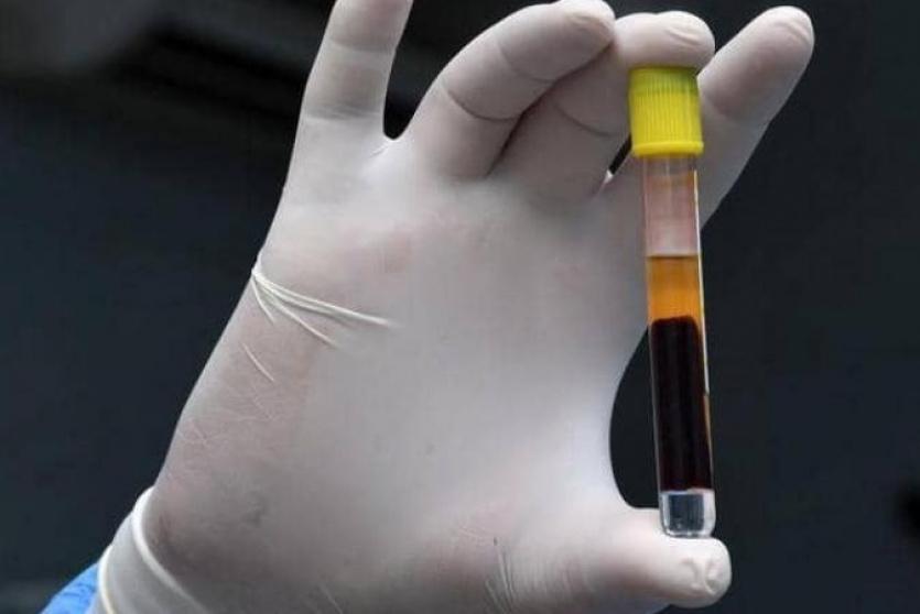 فحصات كورونا 