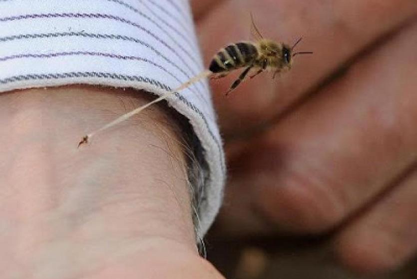 نحلة تلسع يد شخص - توضيحية