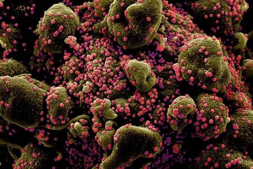 جزيئات فيروس كورونا باللون الأحمر تهاجم خلية بشرية