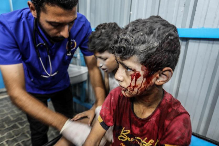 أطفال جرحى في قصف إسرائيلي على غزة