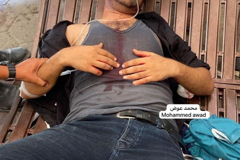 إصابة الصحفي أكرم دلول في غزة
