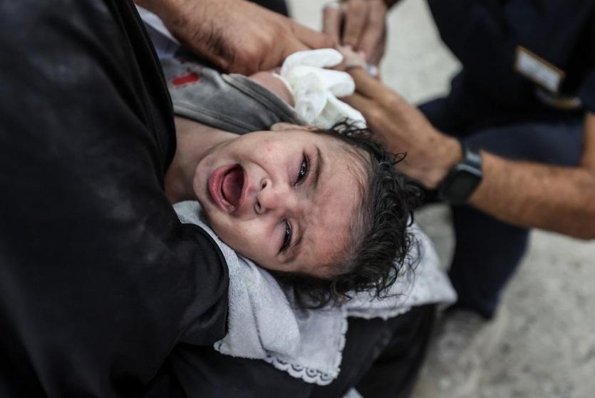 طفل مصاب في غزة