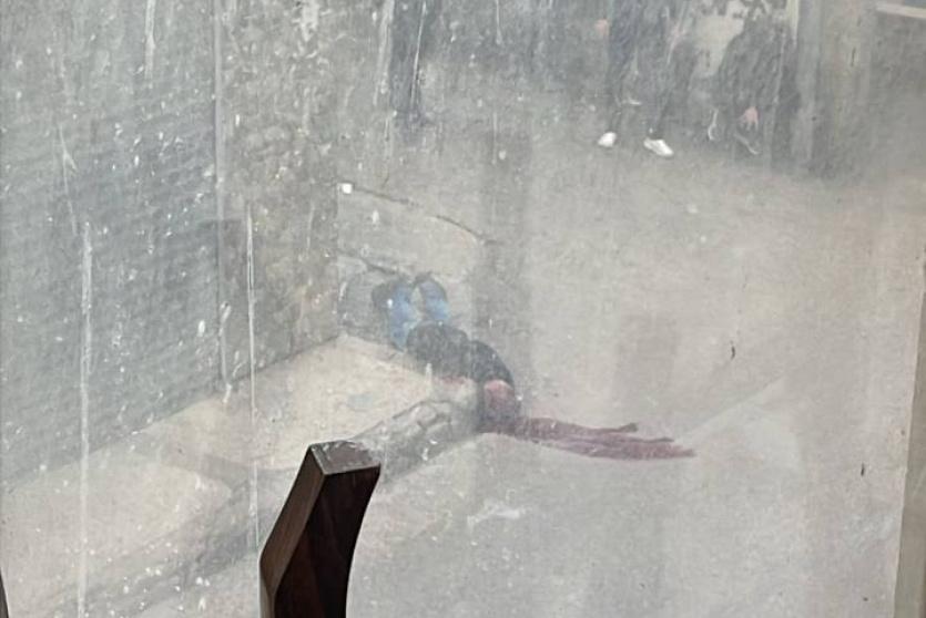 الشاب المصاب في قلنديا