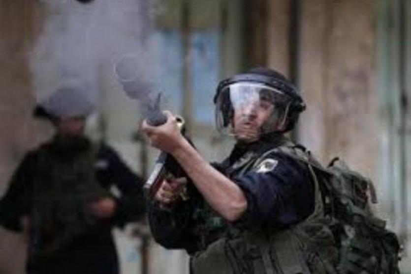 اصابات باقتحام الاحتلال للعيزرية جنوب شرق القدس