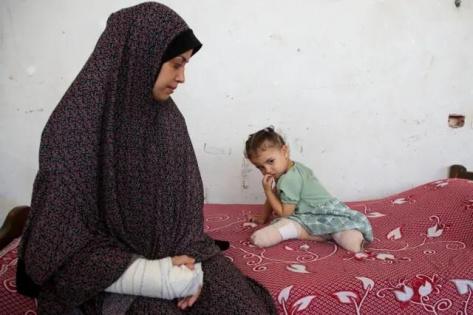 عدد الأطفال مبتوري الأطراف في غزة الأكبر بالعالم: الذخائر غير المنفجرة تهدد جهود إعادة الإعمار