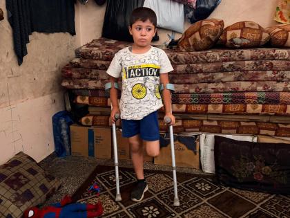 قصة مصورة| أحمد.. إصابةٌ كان يمكن علاجها فانتهت ببتر ساقه