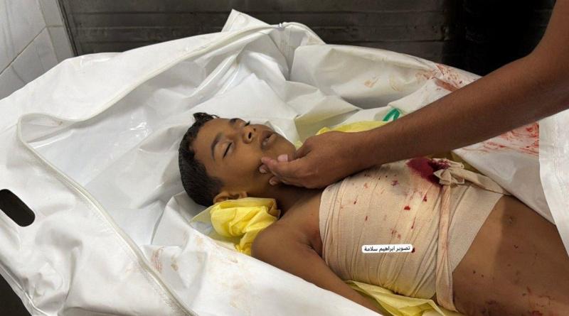 استشهاد طفل بنيران الاحتلال وجرحى في قصف على مدينة خان يونس
