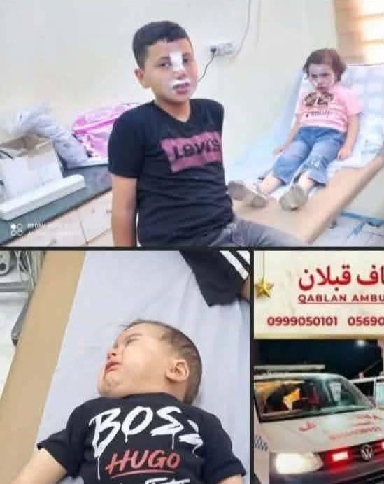 إصابة أفراد عائلة بالاختناق إثر اعتداء مستوطنين قرب بلدة عقربا