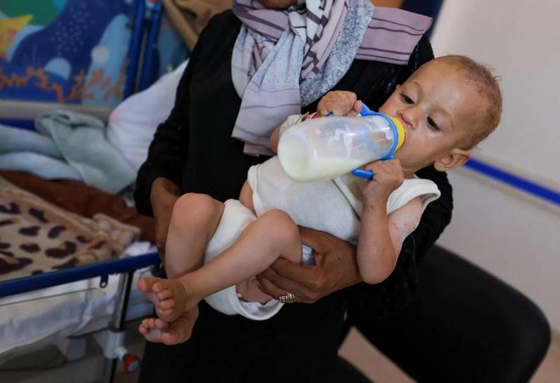 طبيب في مجمع ناصر لراية: سوء التغذية يهدد جيلا كاملا في غزة